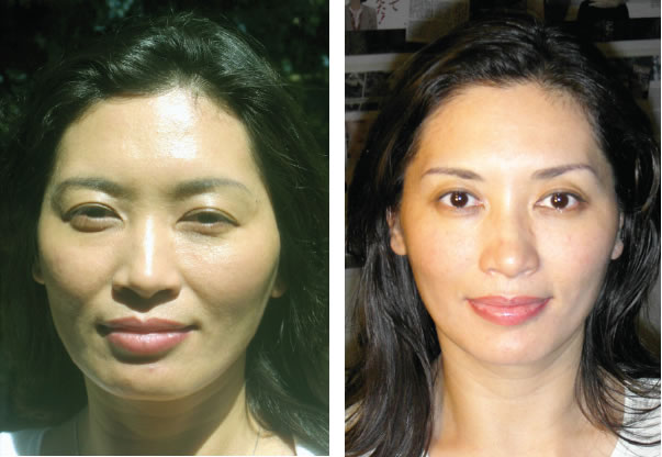 Rejuvenation Example 1